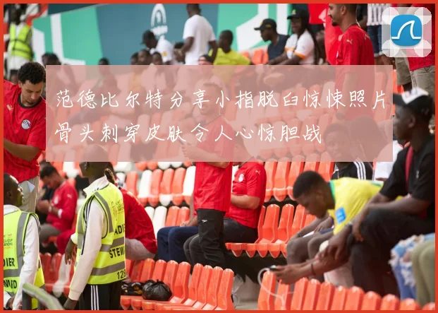 范德比尔特分享小指脱臼惊悚照片骨头刺穿皮肤令人心惊胆战